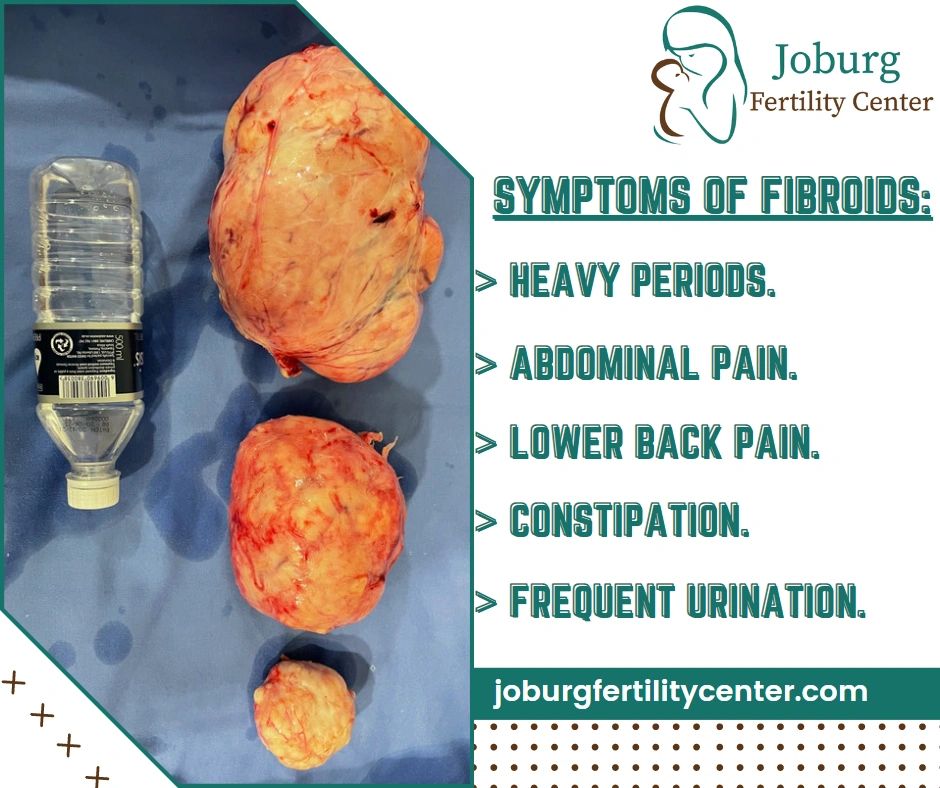 What Are The Fibroids 